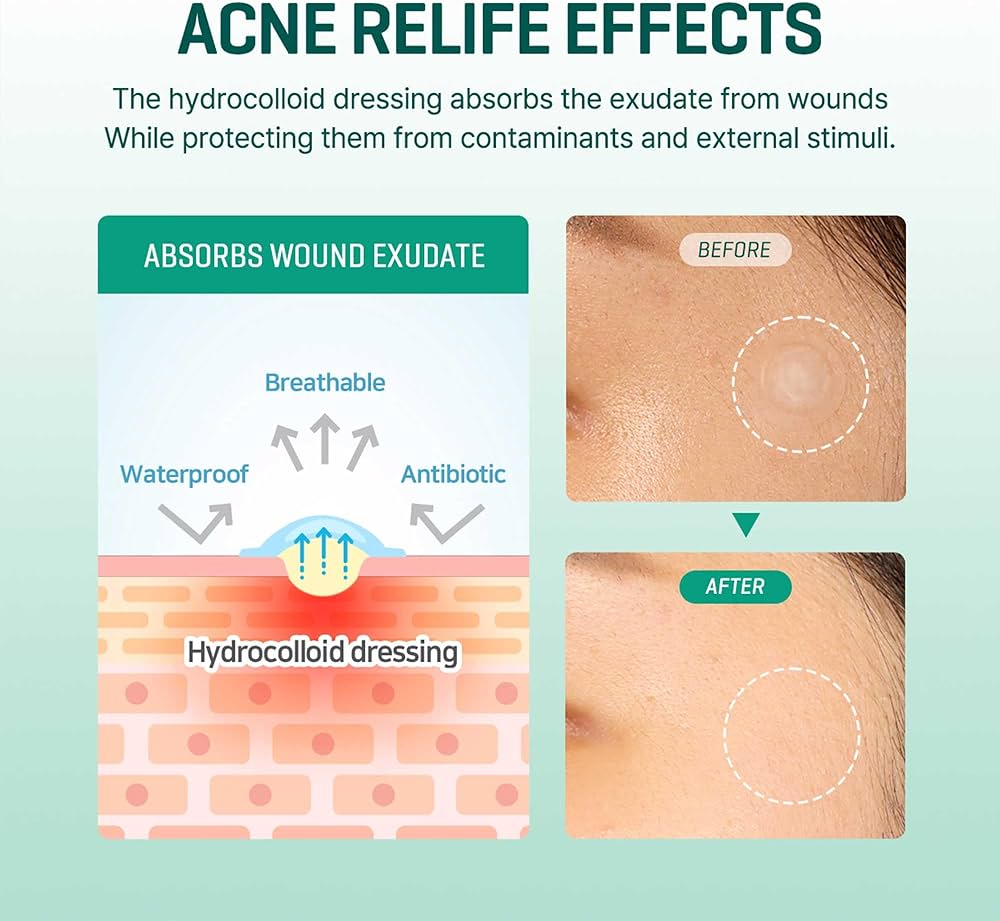 SOME BY MI - 30 Days Miracle Clear Spot Patch [18 pcs]